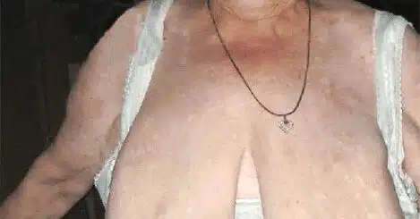 Alte Möse aus Niederösterreich